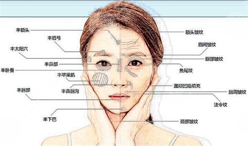 玻尿酸除皱手术有没有果