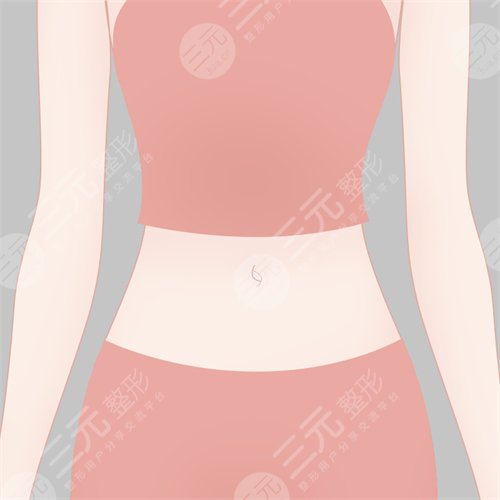 于显旭吸脂瘦腰前