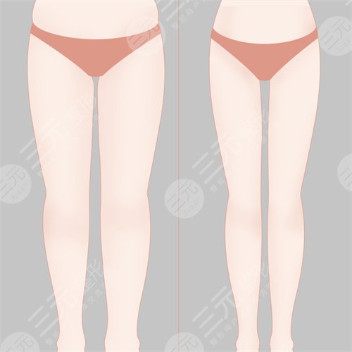 于显旭吸脂瘦腰后果