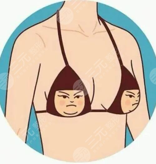 假体隆胸术前的准备事宜都有哪些?