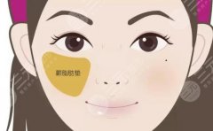 脂肪填充苹果肌会不会下垂?科普解答优点&注意事项,你的术前指南! 脂肪填充苹果肌会不会下垂?科普解答优点&注意事项,你的术前指南!