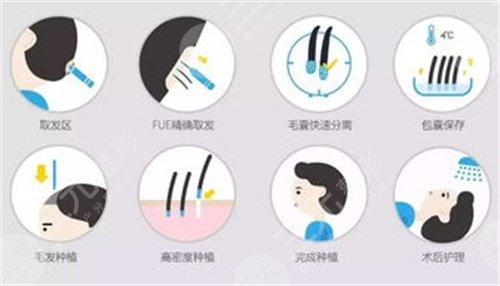 沈阳植发收费标准