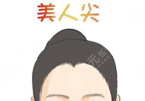 植发美人尖多少钱？价格&果图欣赏，2022“魔发”秘籍来袭！