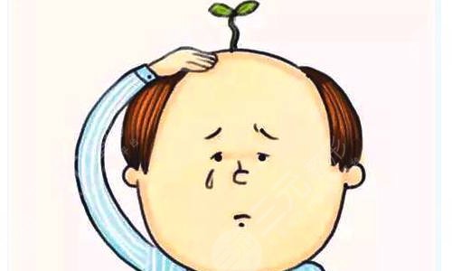 头顶植发需要多少钱，多少个单位？攻略分享，附2022参考价！