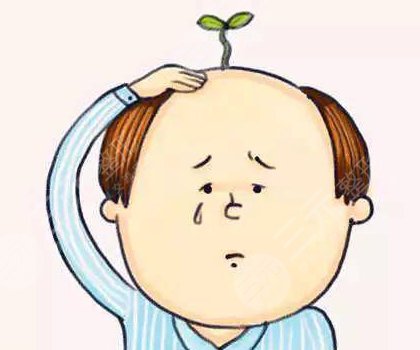 全秃植发大概需要多少钱?2022费用参考&手术科普来袭! 全秃植发大概需要多少钱?2022费用参考&手术科普来袭!