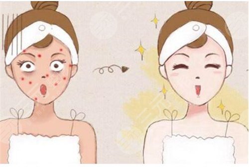 激光嫩肤美白多少钱一次?