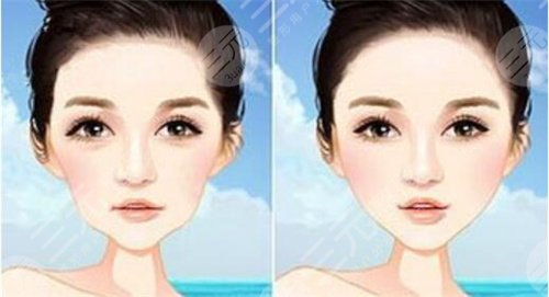 激光嫩肤美白真的有用吗?