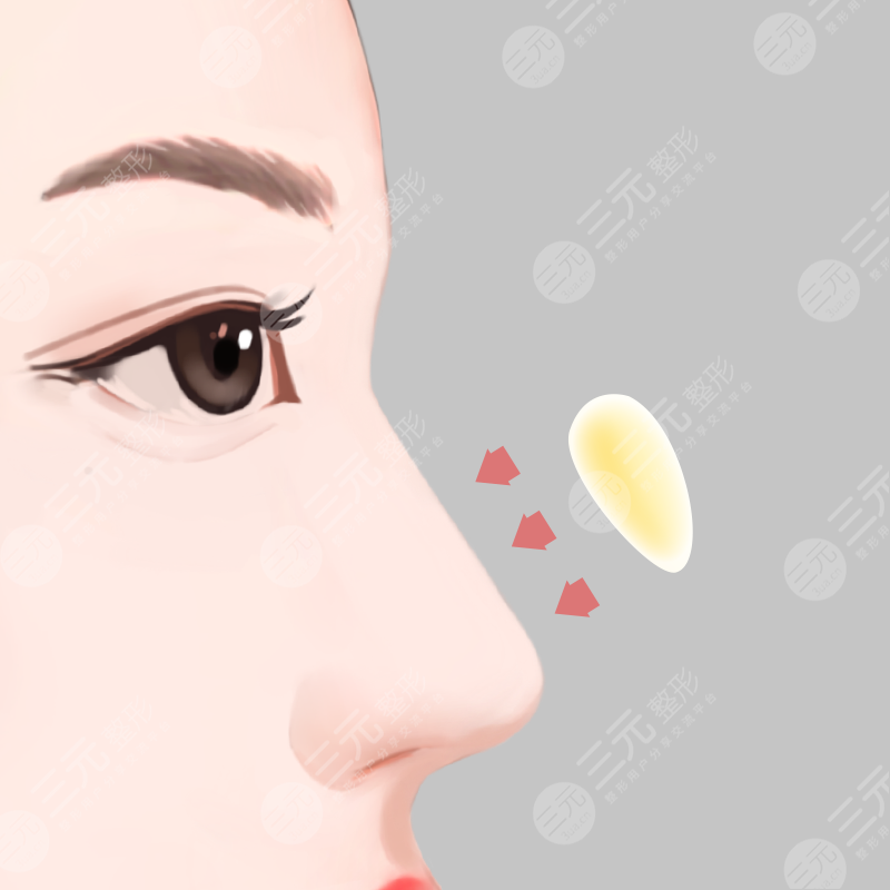 北京鼻部整形医院医生排名(柏丽李劲良、京民王志坚等实力入选)