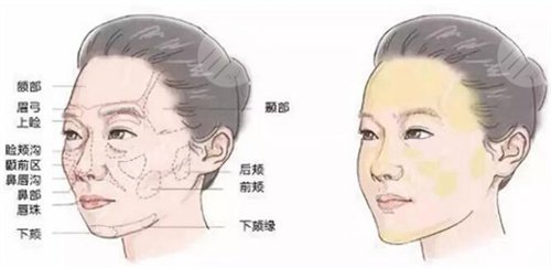注射除皱术案例反馈术前