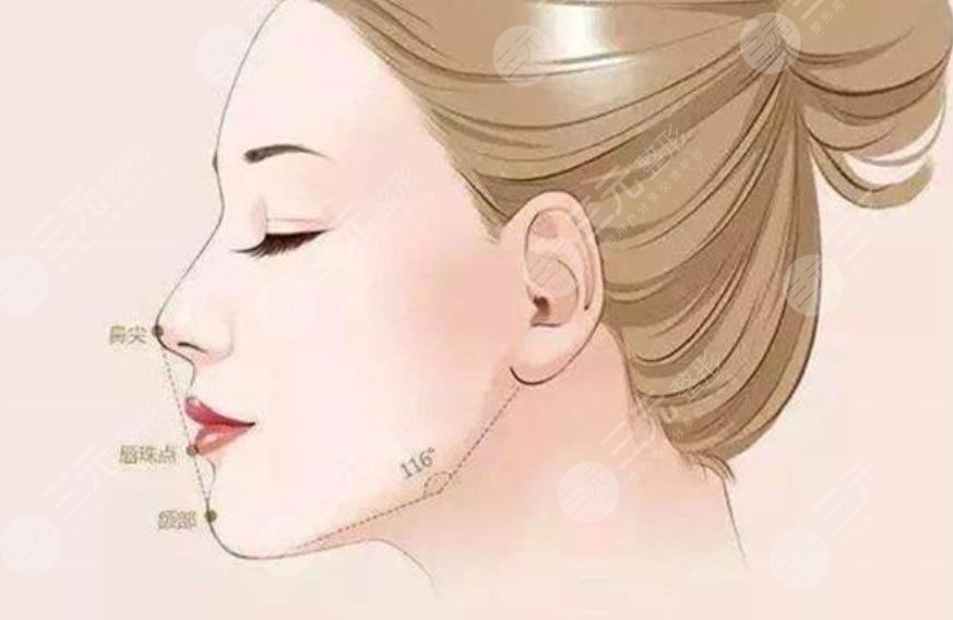 下颌缘吸脂