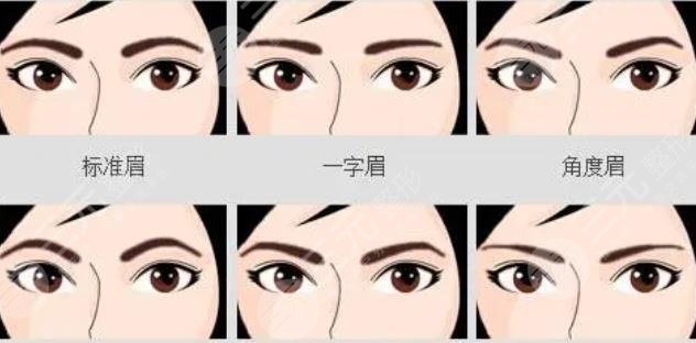 种植眉毛