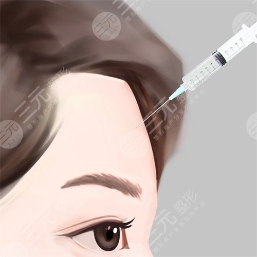 脂肪填充脸部案例分享