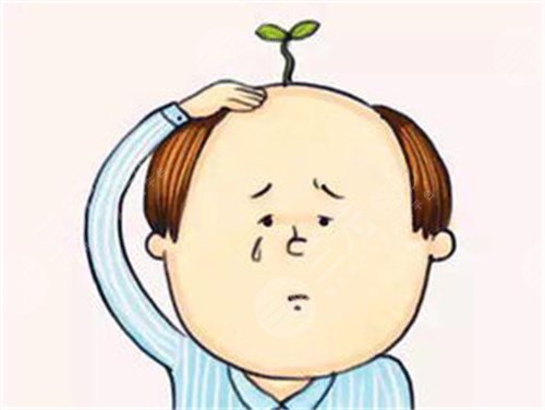 上海九院植发手术经历