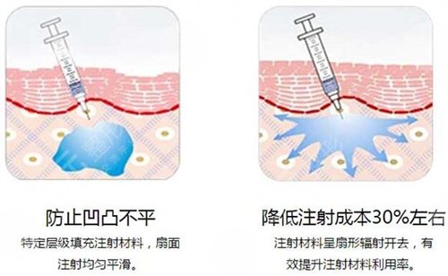 去鼻唇沟3