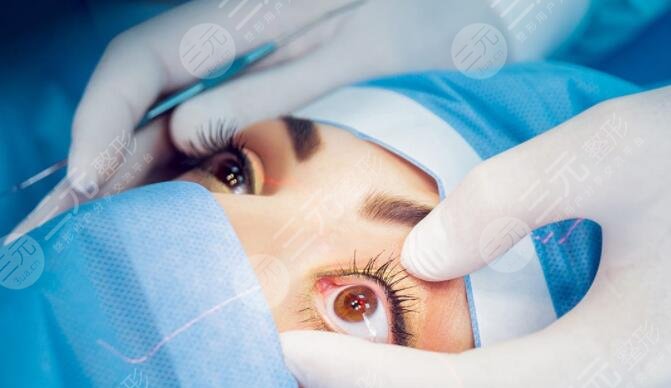 近视眼激光手术安不没问题?