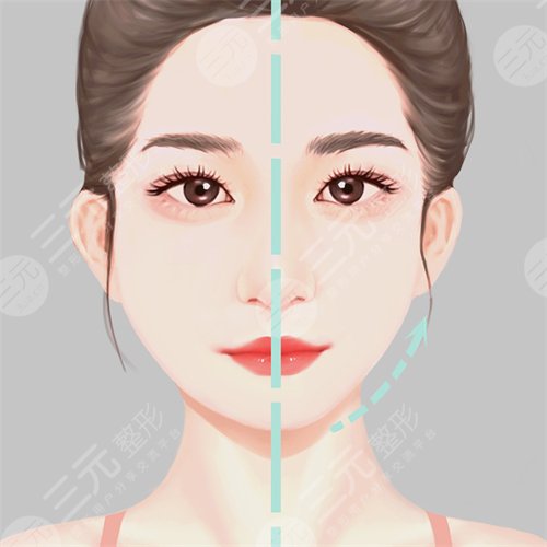 自体脂肪额头填充的果图