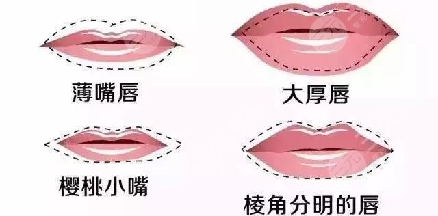 厚唇改薄术果怎么样会留疤吗