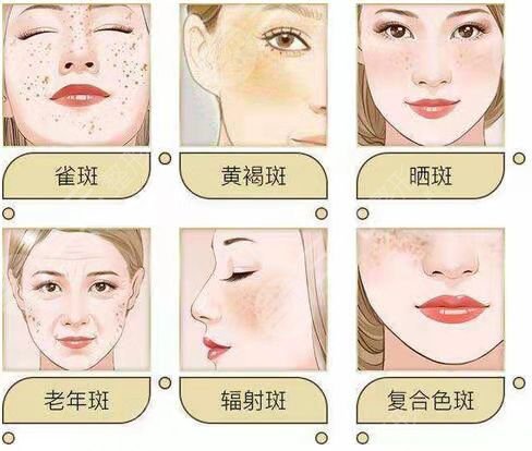 北京八大处热玛吉后