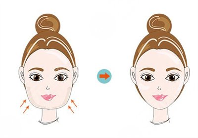 一针瘦脸瘦咬肌能维持多久