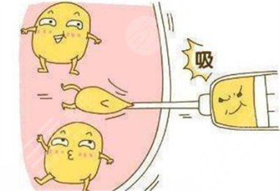 提臀手术怎么做的