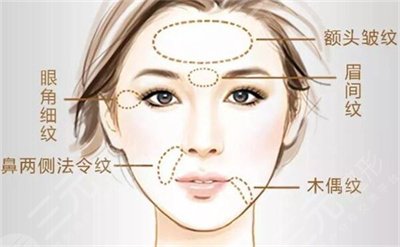 欧洲之星做局部有哪些果?