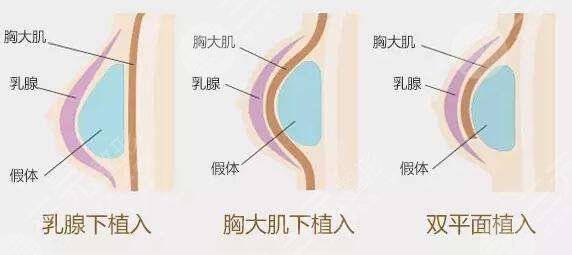 娜绮丽和傲诺拉哪款好？