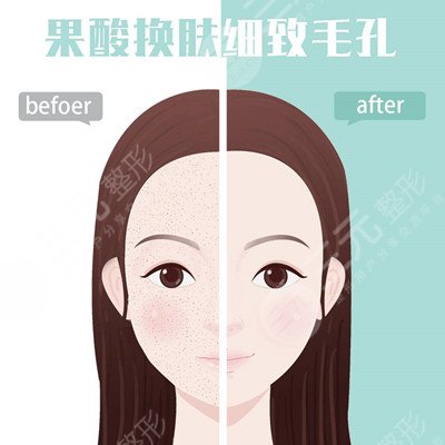 果酸换肤手术之后的半年