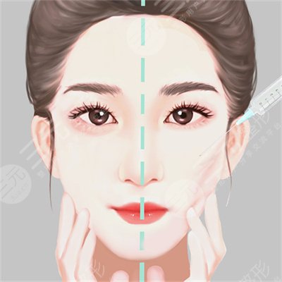 胶原光多久做一次