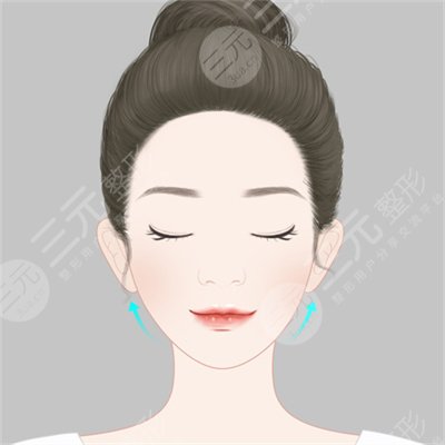 B****注射对比图，B****打几次能定型?