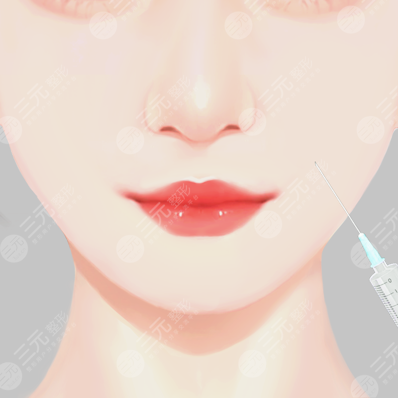 咬肌瘦脸多久打一次？能维持多久？这几点注意事项要记住！
