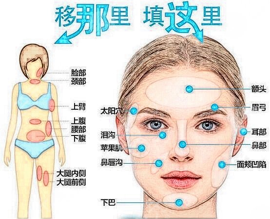 自体脂肪填充后遗症有哪些？别担心！做好这几点无后顾之忧~