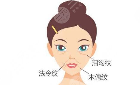 泪沟填充有哪些手术方术?优缺点是什么?