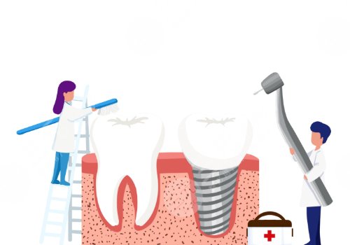 2022全国种植牙价格表种植牙的价格表