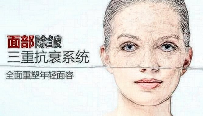 额头皱纹比较: