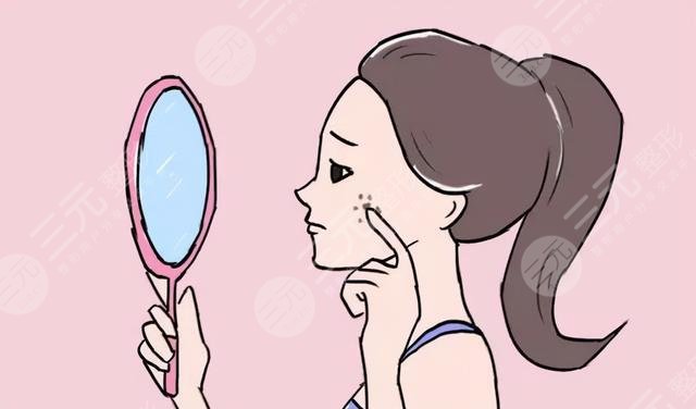 激光点痣后多久恢复?有什么主意事项?