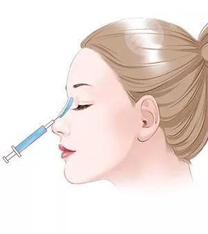硅胶隆鼻多久能恢复好?硅胶隆鼻多久拆线?