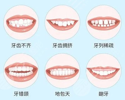 重庆齐美口腔医院怎么样？附医生介绍+牙齿矫正经历分享