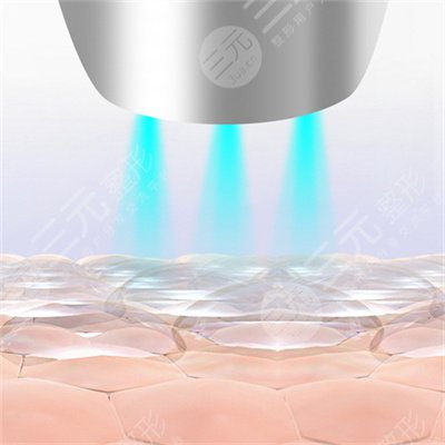 嗨体的具体功有哪些?