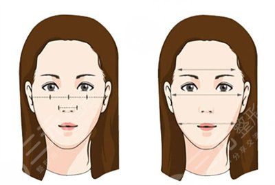 注射瘦脸能维持多久呢
