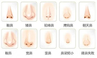 上海DA美联臣隆鼻案例欣赏