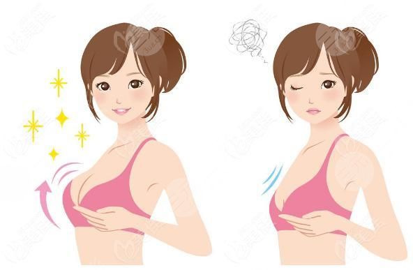 韩式隆胸好吗  韩式隆胸果如何