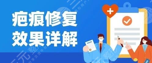 王连召医生祛疤项目科普