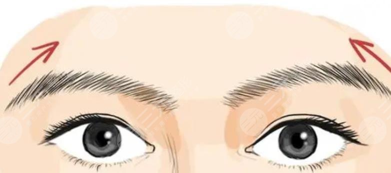 种植眉毛