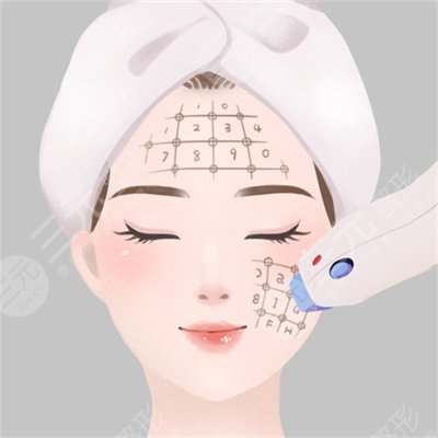 新一代热玛吉做一次多少钱