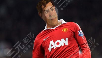 鲁尼植发的果大家有目共睹前后对比变化真大