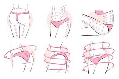 分享腰腹环吸案例，看看我腰腹环吸一个月的图片吧~