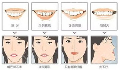 2020年！更新常熟口腔医院排名榜，附真实案例图~