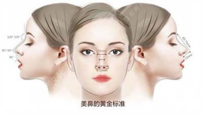 隆鼻术后照