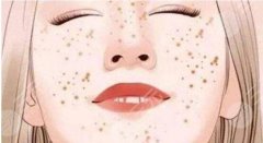 超激光美肤祛斑果怎么样，要注意什么？2022净肤攻略为你科普！
