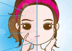 超激光美肤间隔多久做一次好？适合哪些人？2022祛斑美白手册为你科普！